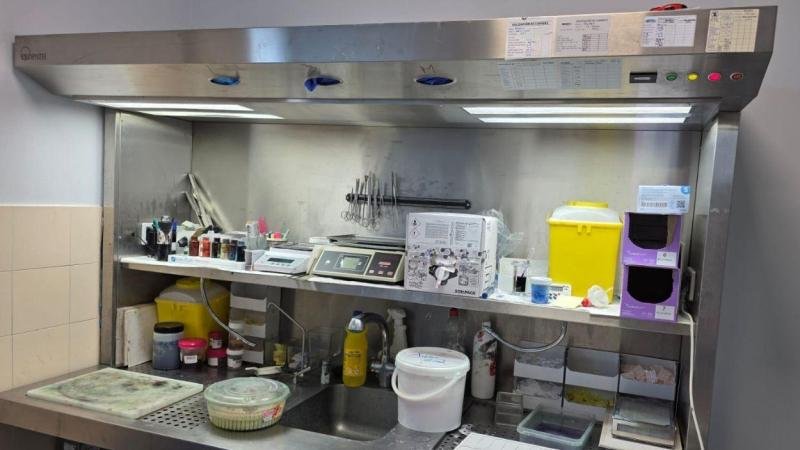ALERTAN DE «RIESGOS QUÍMICOS» EN PATOLÓGICA DEL HOSPITAL DEL TAJO EN ARANJUEZ